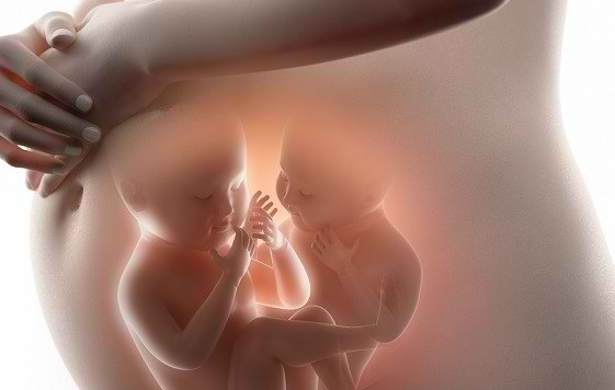 Komplikasi Kehamilan Kembar pada Bayi dan Ibu Hamil