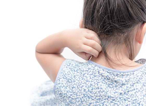 Gejala Alergi Obat pada Anak yang Harus Diketahui para Orang Tua
